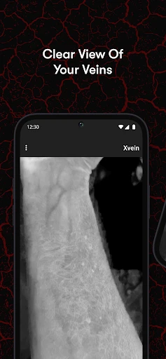 X-Vein screenshot