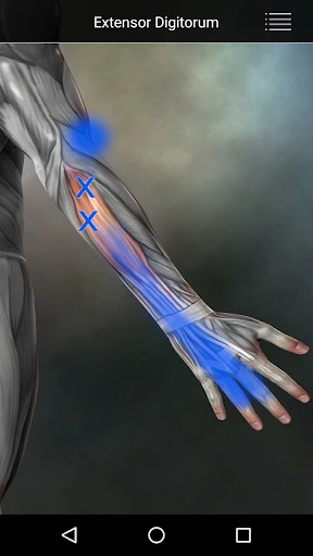 Muscle Trigger Point Anatomy screenshot